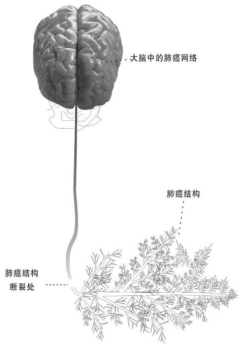 肺癌网络和结构脱落断裂示意图