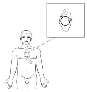 心藏的太极器官