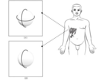 张仲景小柴胡汤在肝下产生的太极器官（三）
