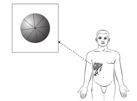 张仲景小柴胡汤在肝下产生的太极器官（四）