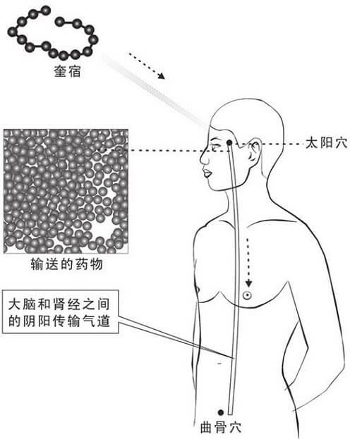 大药输送（左侧气道）
