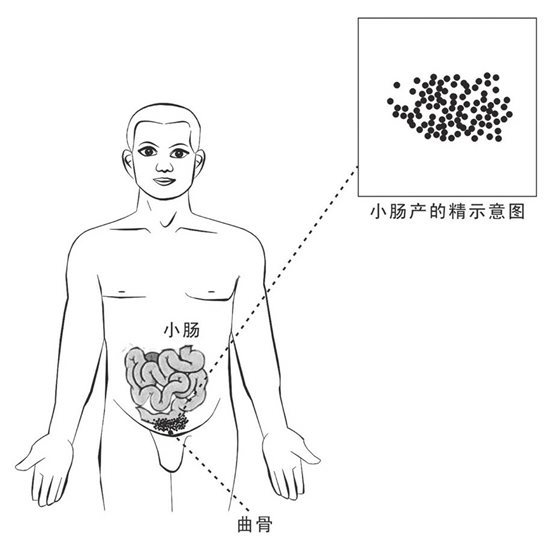 注精入肾