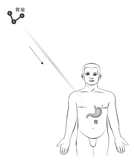胃宿照胃