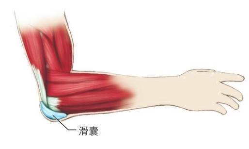 鹰嘴滑囊炎