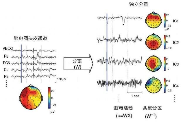 独立分量分析被应用于头皮脑电图记录