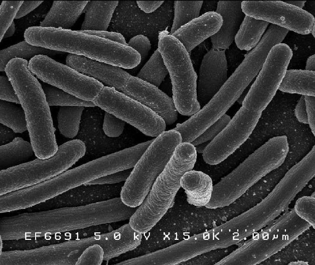 大肠杆菌的扫描电子显微照片