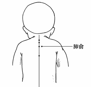 第六章 婴幼儿护理——全面打好孩子的根基
